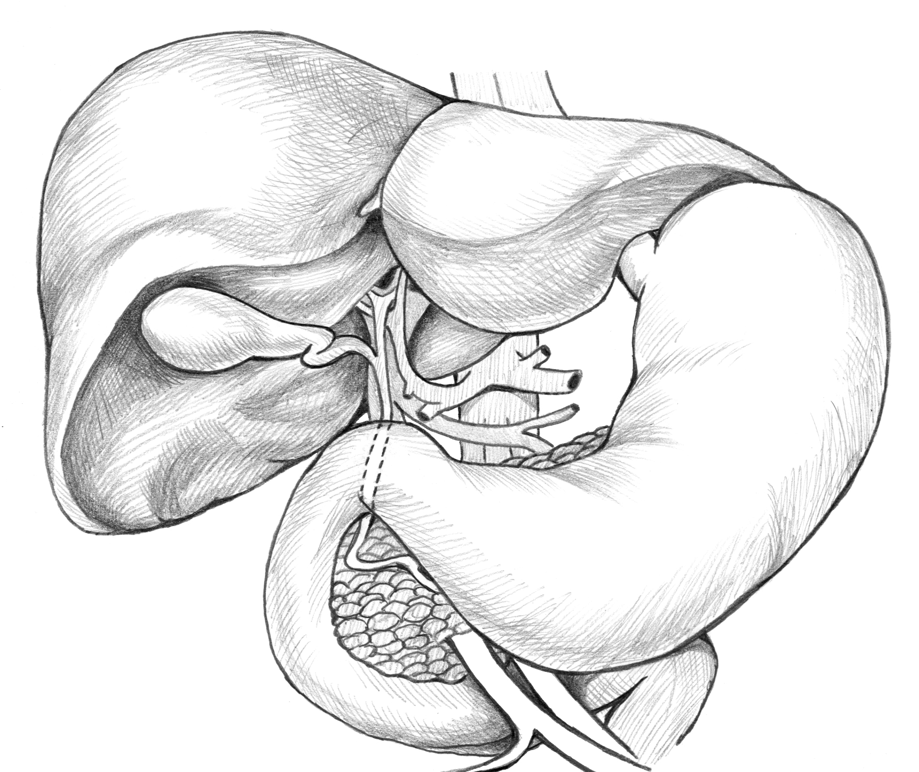 Liver Drawing at Explore collection of Liver Drawing